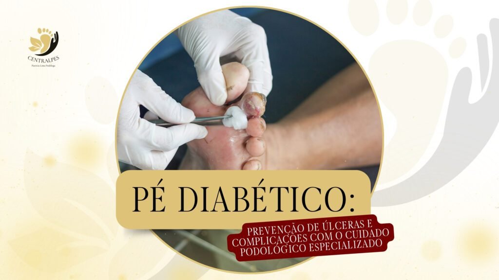 Pé diabético: prevenção de úlceras e complicações com o cuidado podológico especializado